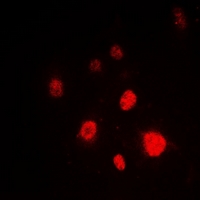 XRCC5 / Ku80 Antibody - Immunofluorescent analysis of Ku80 staining in HeLa cells. Formalin-fixed cells were permeabilized with 0.1% Triton X-100 in TBS for 5-10 minutes and blocked with 3% BSA-PBS for 30 minutes at room temperature. Cells were probed with the primary antibody in 3% BSA-PBS and incubated overnight at 4 deg C in a humidified chamber. Cells were washed with PBST and incubated with a DyLight 594-conjugated secondary antibody (red) in PBS at room temperature in the dark. DAPI was used to stain the cell nuclei (blue).