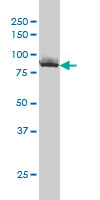 XRCC5 / Ku80 Antibody - XRCC5 monoclonal antibody (M02), clone 3D8. Western blot of XRCC5 expression in A-431.