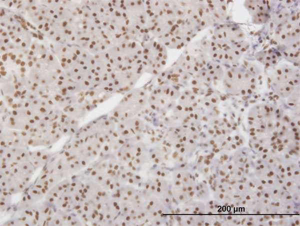 XRCC5 / Ku80 Antibody - Immunoperoxidase of monoclonal antibody to XRCC5 on formalin-fixed paraffin-embedded human pancreas. [antibody concentration 3 ug/ml]