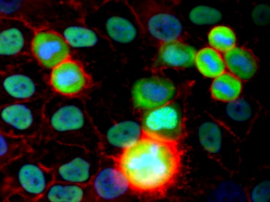 XRCC5 / Ku80 Antibody - Immunofluorescence staining of HeLa human cervix carcinoma cell line using purified anti-Ku Antigen (MEM-54) (detection by Goat anti-mouse IgG2a  488; green).  Actin (red) was stained with Phalloidin-TRITC, nuclei with DAPI (blue).