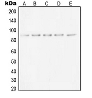 XRCC5 / Ku80 Antibody - Western blot analysis of Ku80 expression in HeLa (A); A431 (B); C32 (C); K562 (D); KNRK (E) whole cell lysates.