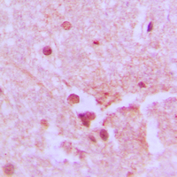 XRCC5 / Ku80 Antibody - Immunohistochemical analysis of Ku80 staining in human brain formalin fixed paraffin embedded tissue section. The section was pre-treated using heat mediated antigen retrieval with sodium citrate buffer (pH 6.0). The section was then incubated with the antibody at room temperature and detected using an HRP conjugated compact polymer system. DAB was used as the chromogen. The section was then counterstained with hematoxylin and mounted with DPX.