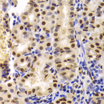 XRCC5 / Ku80 Antibody - Immunohistochemistry of paraffin-embedded Human gastric tissue.