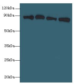 XRCC5 / Ku80 Antibody - Western blot. All lanes: XRCC5 antibody at 6 ug/ml. Lane 1: HepG-2 whole cell lysate. Lane 2: A431 whole cell lysate. Lane 3: 293T whole cell lysate. Lane 4: HeLa whole cell lysate. Secondary Goat polyclonal to Rabbit IgG at 1:10000 dilution. Predicted band size: 83 kDa. Observed band size: 83 kDa.