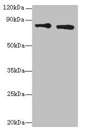 XRCC5 / Ku80 Antibody - Western blot All lanes: XRCC5 antibody at 6µg/ml Lane 1: HepG2 whole cell lysate Lane 2: A431 whole cell lysate Lane 3: 293T whole cell lysate Lane 4: Hela whole cell lysate Secondary Goat polyclonal to rabbit IgG at 1/10000 dilution Predicted band size: 83 kDa Observed band size: 83 kDa