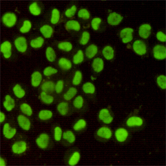 XRCC5 / Ku80 Antibody - Immunofluorescent analysis of HeLa cells using Ku80 mouse monoclonal antibody (1:400).