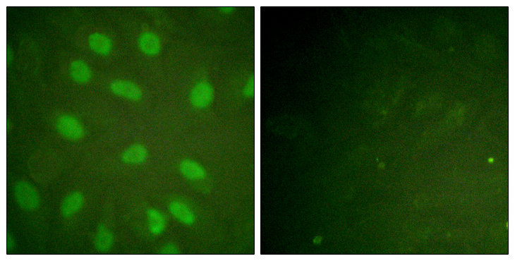 XRCC5 / Ku80 Antibody - Immunofluorescence analysis of HeLa cells, using Ku80 (Phospho-Thr714) Antibody. The picture on the right is blocked with the phospho peptide.