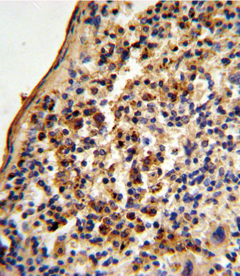 XRCC6 / Ku70 Antibody - Formalin-fixed and paraffin-embedded mouse spleen tissue reacted with Ku70 Antibody , which was peroxidase-conjugated to the secondary antibody, followed by DAB staining. This data demonstrates the use of this antibody for immunohistochemistry; clinical relevance has not been evaluated.