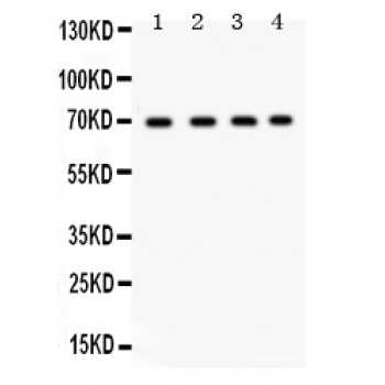 XRCC6 / Ku70 Antibody - Ku70 antibody Western blot. All lanes: Anti at 0.5 ug/ml. Lane 1: A549 Whole Cell Lysate at 40 ug. Lane 2: HELA Whole Cell Lysate at 40 ug. Lane 3: HEPG2 Whole Cell Lysate at 40 ug. Lane 4: MCF-7 Whole Cell Lysate at 40 ug. Predicted band size: 70 kD. Observed band size: 70 kD.