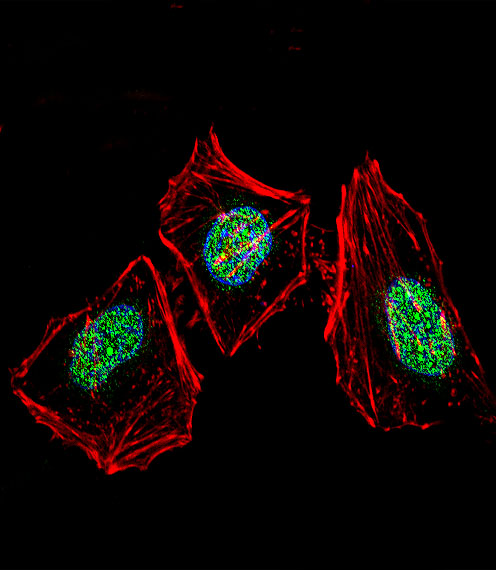 XRCC6 / Ku70 Antibody - Fluorescent confocal image of HeLa cell stained with XRCC6 Antibody. HeLa cells were fixed with 4% PFA (20 min), permeabilized with Triton X-100 (0.1%, 10 min), then incubated with XRCC6 primary antibody (1:25, 1 h at 37°C). For secondary antibody, Alexa Fluor 488 conjugated donkey anti-rabbit antibody (green) was used (1:400, 50 min at 37°C). Cytoplasmic actin was counterstained with Alexa Fluor 555 (red) conjugated Phalloidin (7units/ml, 1 h at 37°C). Nuclei were counterstained with DAPI (blue) (10 ug/ml, 10 min). XRCC6 immunoreactivity is localized to nucleus significantly and Cytoplasm weakly.