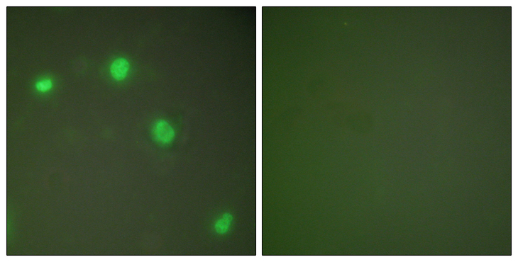 XRCC6 / Ku70 Antibody - Immunofluorescence analysis of COS7 cells, using Ku70 Antibody. The picture on the right is blocked with the synthesized peptide.