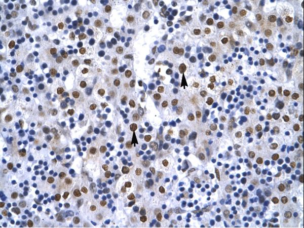 XRCC6 / Ku70 Antibody - XRCC6 / Ku70 antibody ARP34117_T100-NP_001460-G22P1 Antibody was used in IHC to stain formalin-fixed, paraffin-embedded human liver.  This image was taken for the unconjugated form of this product. Other forms have not been tested.