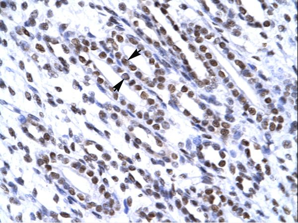 XRCC6 / Ku70 Antibody - XRCC6 / Ku70 antibody ARP34117_T100-NP_001460-G22P1 Antibody was used in IHC to stain formalin-fixed, paraffin-embedded human kidney.  This image was taken for the unconjugated form of this product. Other forms have not been tested.
