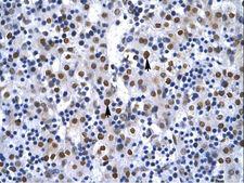 XRCC6 / Ku70 Antibody - XRCC6 / Ku70 antibody ARP34117_T100-NP_001460-G22P1 Antibody was used in IHC to stain formalin-fixed, paraffin-embedded human liver.  This image was taken for the unconjugated form of this product. Other forms have not been tested.