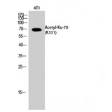 XRCC6 / Ku70 Antibody - Western blot of Acetyl-Ku-70 (K331) antibody