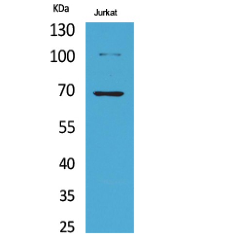 XRCC6 / Ku70 Antibody - Western blot of Acetyl-Ku-70 (K542) antibody