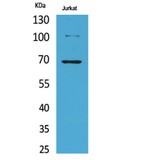 XRCC6 / Ku70 Antibody - Western blot of Acetyl-Ku-70 (K542) antibody