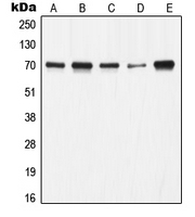 XRCC6 / Ku70 Antibody - Western blot analysis of Ku70 expression in A549 (A); HeLa (B); A673 (C); Jurkat (D); COS7 (E) whole cell lysates.
