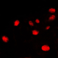 XRCC6 / Ku70 Antibody - Immunofluorescent analysis of Ku70 staining in HeLa cells. Formalin-fixed cells were permeabilized with 0.1% Triton X-100 in TBS for 5-10 minutes and blocked with 3% BSA-PBS for 30 minutes at room temperature. Cells were probed with the primary antibody in 3% BSA-PBS and incubated overnight at 4 C in a humidified chamber. Cells were washed with PBST and incubated with a DyLight 594-conjugated secondary antibody (red) in PBS at room temperature in the dark. DAPI was used to stain the cell nuclei (blue).