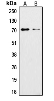 XRCC6 / Ku70 Antibody - Western blot analysis of Ku70 (AcK542) expression in A549 (A); HeLa (B) whole cell lysates.