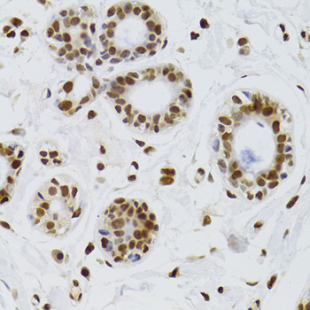 XRCC6 / Ku70 Antibody - Immunohistochemistry of paraffin-embedded human breast using XRCC6 Antibodyat dilution of 1:100 (40x lens).