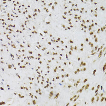 XRCC6 / Ku70 Antibody - Immunohistochemistry of paraffin-embedded human leiomyoma of uterus using XRCC6 Antibodyat dilution of 1:100 (40x lens).