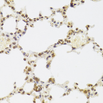XRCC6 / Ku70 Antibody - Immunohistochemistry of paraffin-embedded mouse lung using XRCC6 Antibodyat dilution of 1:100 (40x lens).