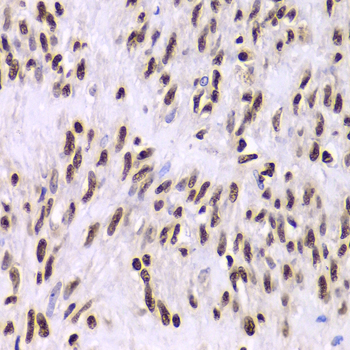 XRCC6 / Ku70 Antibody - Immunohistochemistry of paraffin-embedded human leiomyoma of uterus using XRCC6 Antibodyat dilution of 1:100 (40x lens).