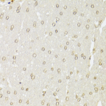 XRCC6 / Ku70 Antibody - Immunohistochemistry of paraffin-embedded rat brain using XRCC6 Antibodyat dilution of 1:100 (40x lens).