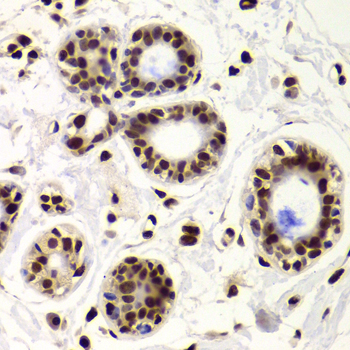 XRCC6 / Ku70 Antibody - Immunohistochemistry of paraffin-embedded Human mammary gland tissue.