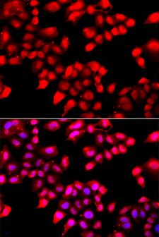 XRCC6 / Ku70 Antibody - Immunofluorescence analysis of A549 cells.