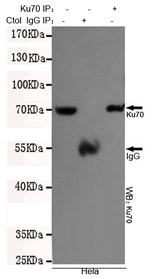 XRCC6 / Ku70 Antibody - Immunoprecipitation analysis of HeLa cell lysates using Ku70 mouse monoclonal antibody.