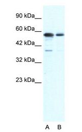 XRCC6 / Ku70 Antibody - XRCC6 / Ku70 antibody Western Blot of HepG2 cell lysate. XRCC6 is supported by BioGPS gene expression data to be expressed in HepG2.  This image was taken for the unconjugated form of this product. Other forms have not been tested.