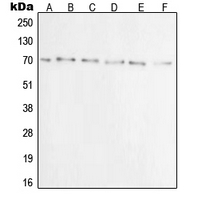 XRCC6 / Ku70 Antibody - Western blot analysis of Ku70 expression in A549 (A); A431 (B); C32 (C); HeLa (D); Jurkat (E); COS7 (F) whole cell lysates.