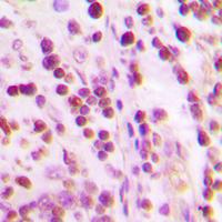 XRCC6 / Ku70 Antibody - Immunohistochemical analysis of Ku70 staining in human tonsil formalin fixed paraffin embedded tissue section. The section was pre-treated using heat mediated antigen retrieval with sodium citrate buffer (pH 6.0). The section was then incubated with the antibody at room temperature and detected using an HRP conjugated compact polymer system. DAB was used as the chromogen. The section was then counterstained with hematoxylin and mounted with DPX.