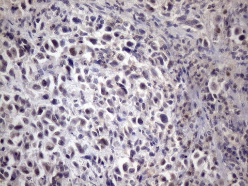 XRCC6BP1 Antibody - Immunohistochemical staining of paraffin-embedded Human bladder tissue within the normal limits using anti-XRCC6BP1 mouse monoclonal antibody. (Heat-induced epitope retrieval by 1mM EDTA in 10mM Tris buffer. (pH8.5) at 120 oC for 3 min. (1:150)