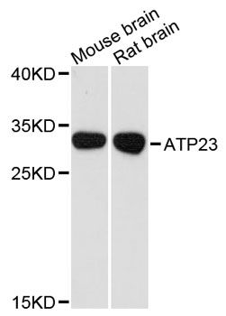 XRCC6BP1 Antibody - Western blot analysis of extracts of various cell lines, using ATP23 antibody at 1:3000 dilution. The secondary antibody used was an HRP Goat Anti-Rabbit IgG (H+L) at 1:10000 dilution. Lysates were loaded 25ug per lane and 3% nonfat dry milk in TBST was used for blocking. An ECL Kit was used for detection and the exposure time was 90s.