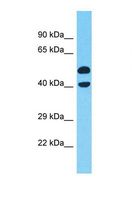 XRG8 / XKR8 Antibody - Western blot of Human COLO205. XKR8 antibody dilution 1.0 ug/ml.  This image was taken for the unconjugated form of this product. Other forms have not been tested.