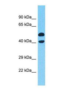 XRG8 / XKR8 Antibody - Western blot of Human COLO205. XKR8 antibody dilution 1.0 ug/ml.  This image was taken for the unconjugated form of this product. Other forms have not been tested.