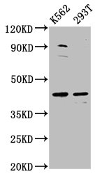 XRG8 / XKR8 Antibody - Western Blot Positive WB detected in:K562 whole cell lysate, 293T whole cell lysate All Lanes:XKR8 antibody at 3.4µg/ml Secondary Goat polyclonal to rabbit IgG at 1/50000 dilution Predicted band size: 45 KDa Observed band size: 45 KDa