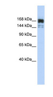 XRN1 Antibody - XRN1 antibody Western blot of MCF7 cell lysate. This image was taken for the unconjugated form of this product. Other forms have not been tested.
