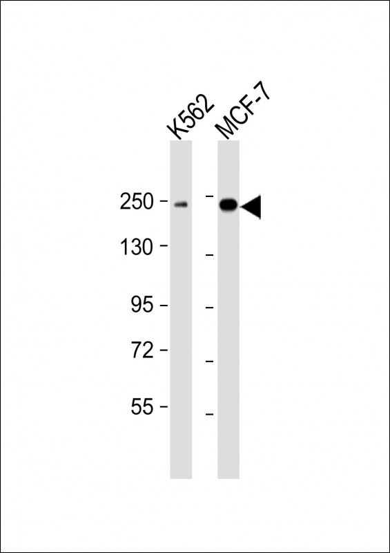 XRN1 Antibody - All lanes: Anti-XRN1 Antibody at 1:2000 dilution. Lane 1: K562 whole cell lysate. Lane 2: MCF-7 whole cell lysate Lysates/proteins at 20 ug per lane. Secondary Goat Anti-mouse IgG, (H+L), Peroxidase conjugated at 1:10000 dilution. Predicted band size: 194 kDa. Blocking/Dilution buffer: 5% NFDM/TBST.