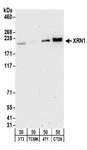 XRN1 Antibody - Detection of Mouse XRN1 by Western Blot. Samples: Whole cell lysate (50 ug) from NIH3T3, TCMK-1, 4T1, and CT26.WT cells. Antibodies: Affinity purified rabbit anti-XRN1 antibody used for WB at 0.2 ug/ml. Detection: Chemiluminescence with an exposure time of 3 minutes.