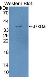 XRN1 Antibody - Western Blot; Sample: Recombinant protein.