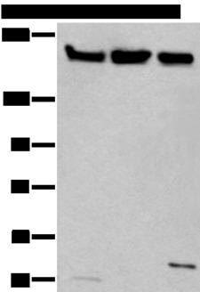 XRN1 Antibody - Western blot analysis of Hela 231 and K562 cell lysates  using XRN1 Polyclonal Antibody at dilution of 1:250