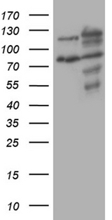 XRN2 Antibody - HEK293T cells were transfected with the pCMV6-ENTRY control. (Left lane) or pCMV6-ENTRY XRN2. (Right lane) cDNA for 48 hrs and lysed. Equivalent amounts of cell lysates. (5 ug per lane) were separated by SDS-PAGE and immunoblotted with anti-XRN2. (1:2000)
