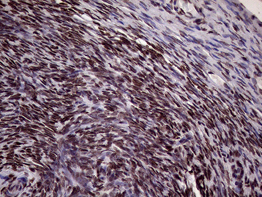 XRN2 Antibody - Immunohistochemical staining of paraffin-embedded Human Ovary tissue within the normal limits using anti-XRN2 mouse monoclonal antibody. (Heat-induced epitope retrieval by 1mM EDTA in 10mM Tris buffer. (pH8.5) at 120°C for 3 min. (1:2000)