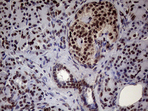 XRN2 Antibody - Immunohistochemical staining of paraffin-embedded Human pancreas tissue within the normal limits using anti-XRN2 mouse monoclonal antibody. (Heat-induced epitope retrieval by 1mM EDTA in 10mM Tris buffer. (pH8.5) at 120°C for 3 min. (1:2000)