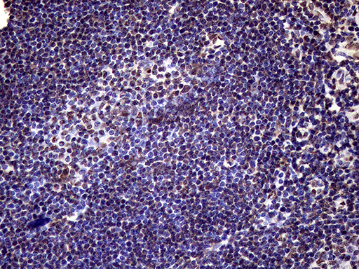 XRN2 Antibody - Immunohistochemical staining of paraffin-embedded Human tonsil within the normal limits using anti-XRN2 mouse monoclonal antibody. (Heat-induced epitope retrieval by 1mM EDTA in 10mM Tris buffer. (pH8.5) at 120°C for 3 min. (1:2000)