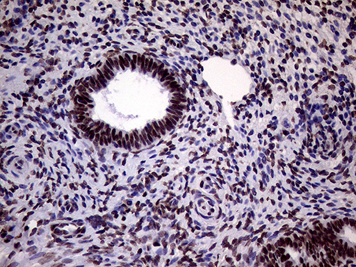 XRN2 Antibody - Immunohistochemical staining of paraffin-embedded Human endometrium tissue within the normal limits using anti-XRN2 mouse monoclonal antibody. (Heat-induced epitope retrieval by 1mM EDTA in 10mM Tris buffer. (pH8.5) at 120°C for 3 min. (1:2000)
